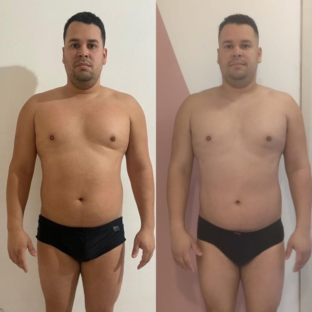 Experiência compartilhada — comparação frontal